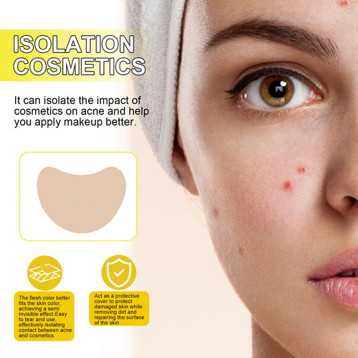 Hydrocolloid Acne Patches for Discreet Blemish Cover