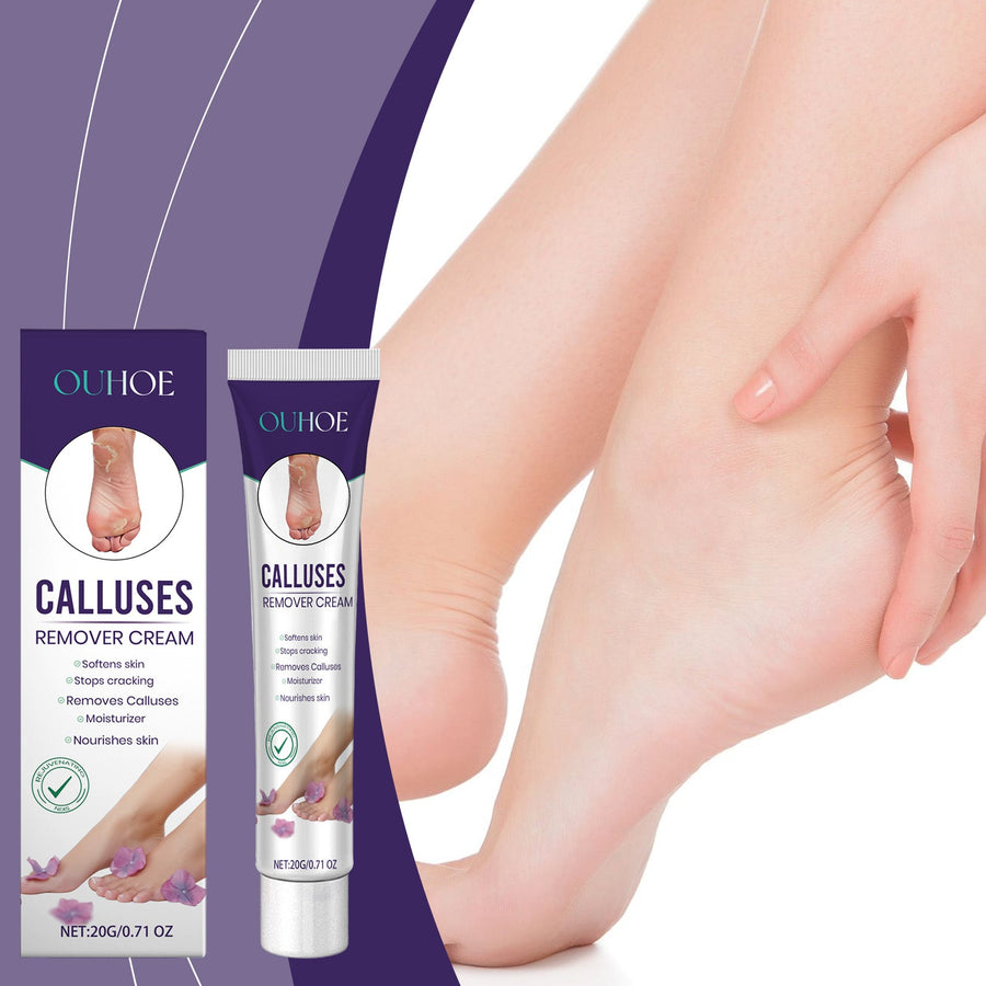 Foot Callus Removal Cream for Soft, Crack-Free Heels