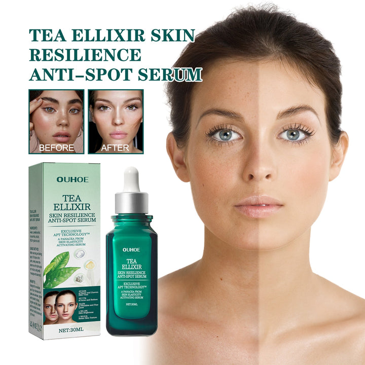 Brightening Blemish Essence for Dark Spots & Melasma