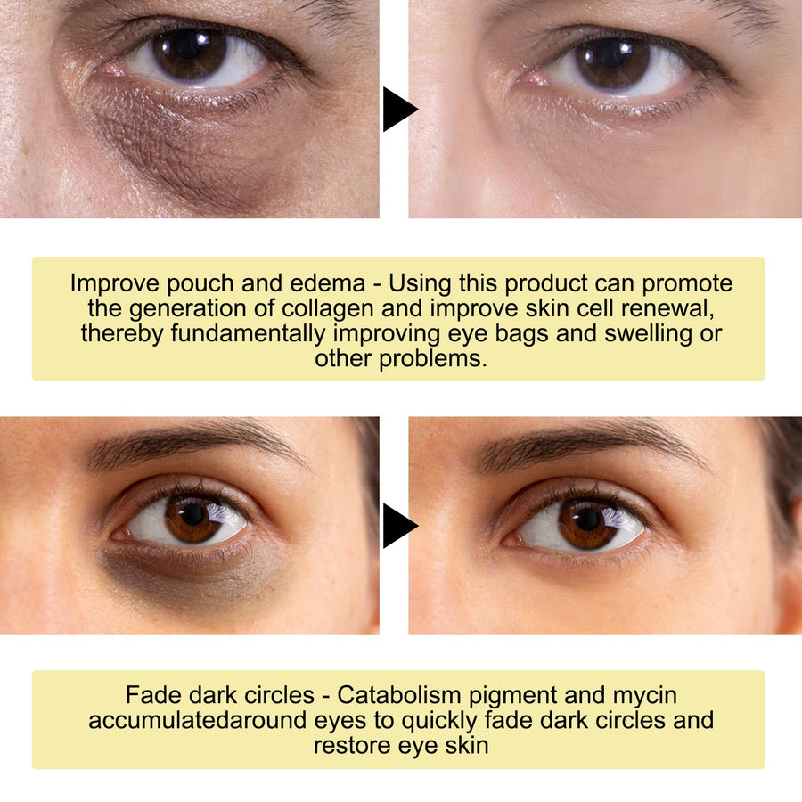 Gold Snail Collagen Eye Masks for Puffy, Tired Eyes
