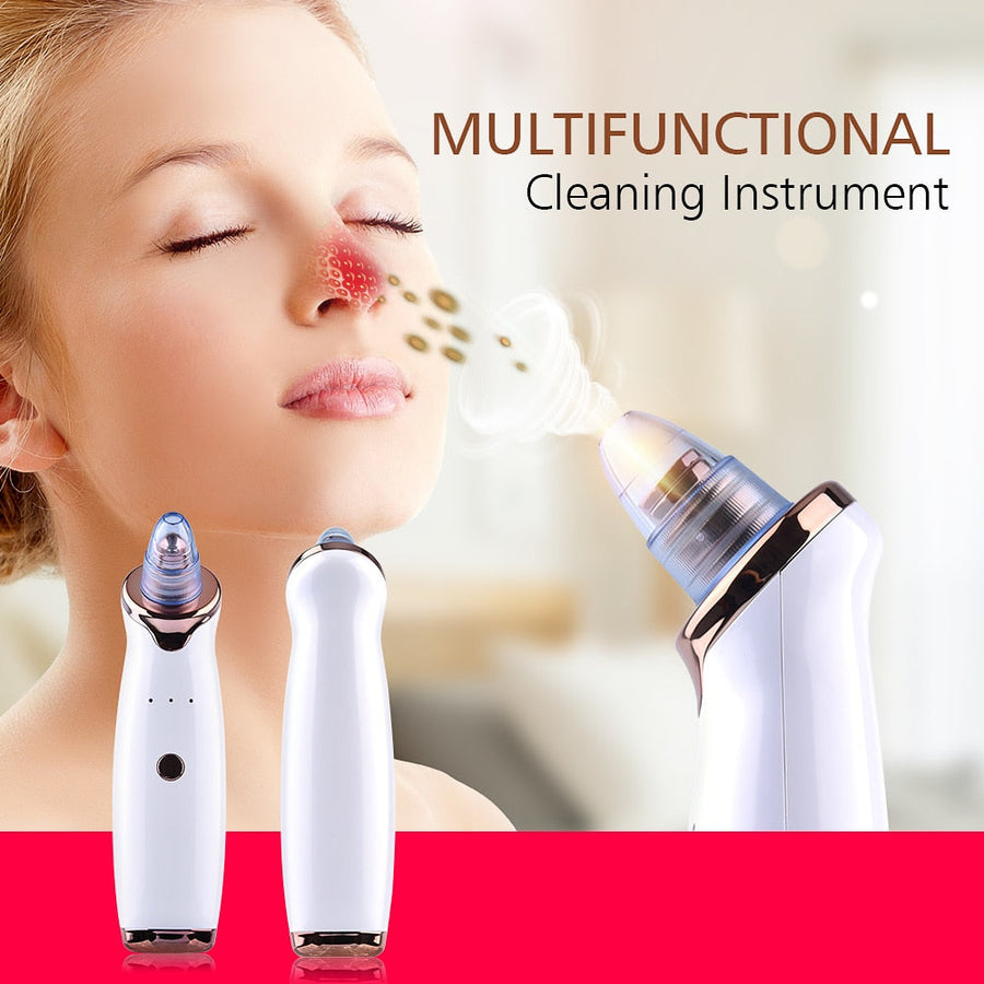 Pore Vacuum Blackhead Remover for Cleaner-Looking Pores