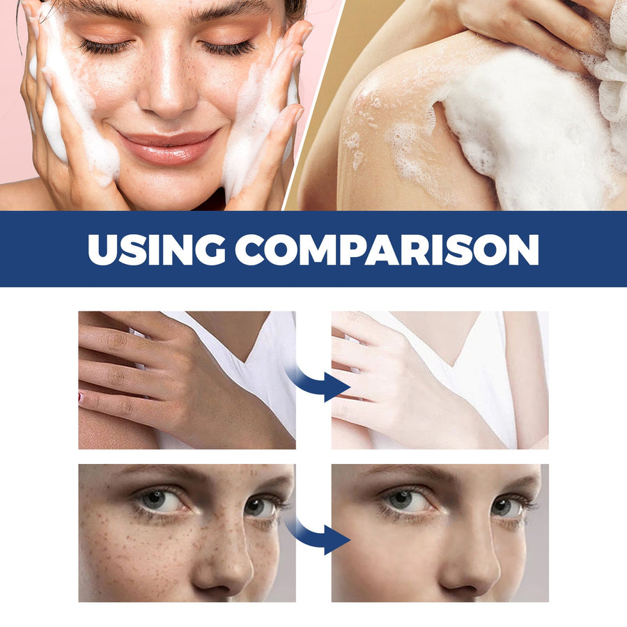 Spot Body Cleanser for Face, Freckles & Uneven Tone