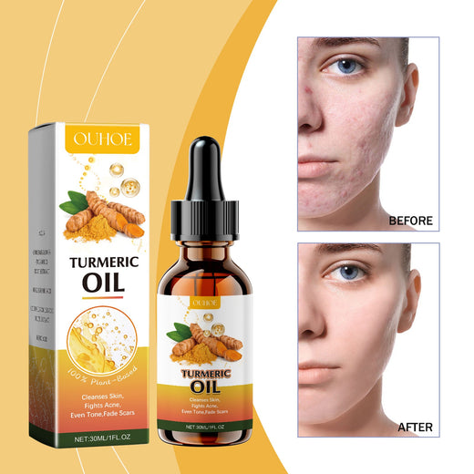 Turmeric Cleansing Oil for Acne Scars & Uneven Tone