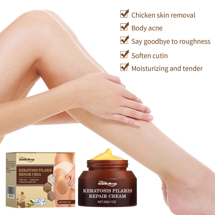 Body Cream for Keratosis Pilaris & Bumpy Skin Texture