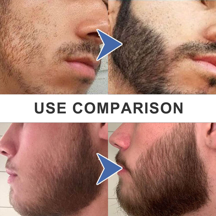 Beard Filler Pen Set — Instant Defined & Fuller Beard