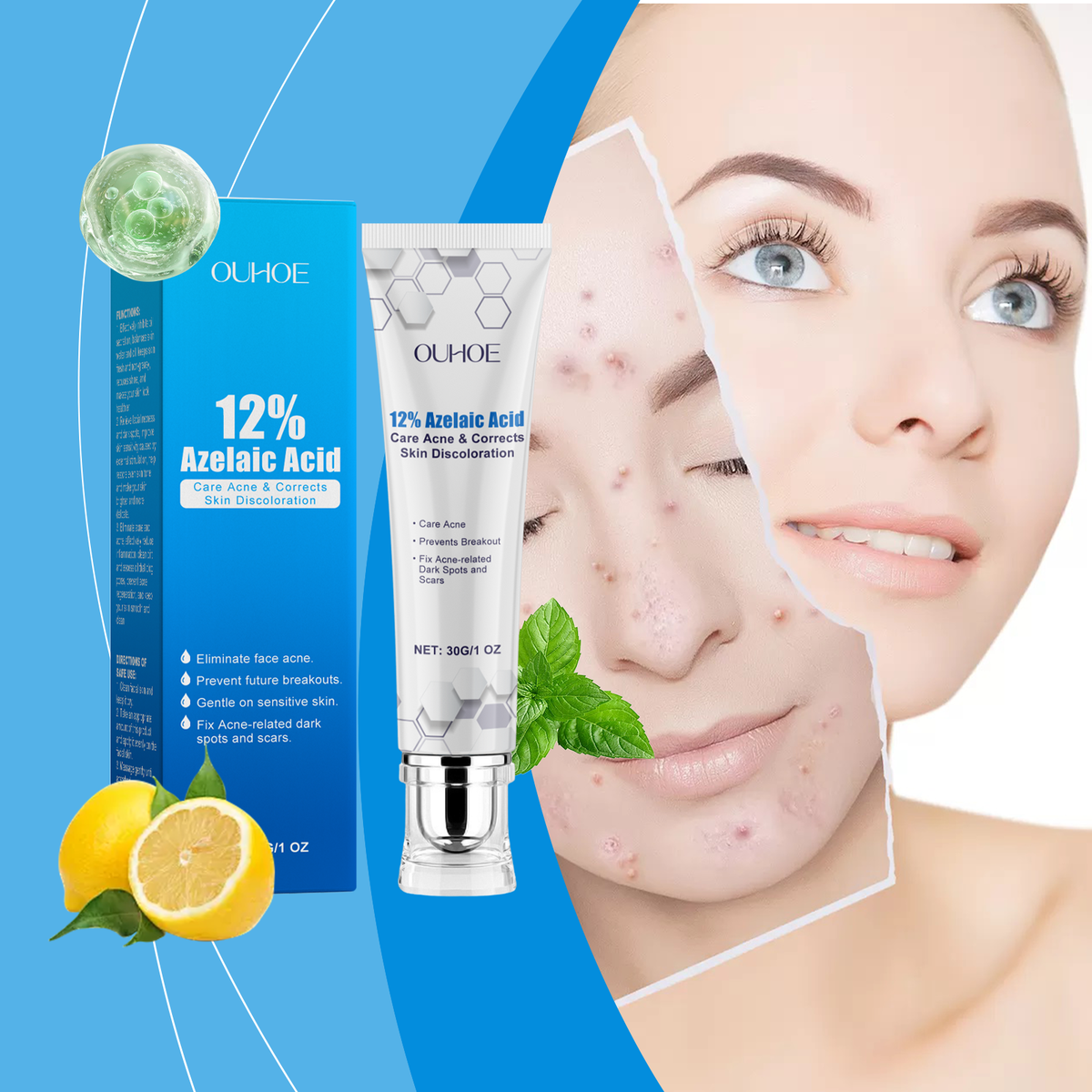 Azelaic Acid 12% Acne Cream For Acne And Dark Spots
