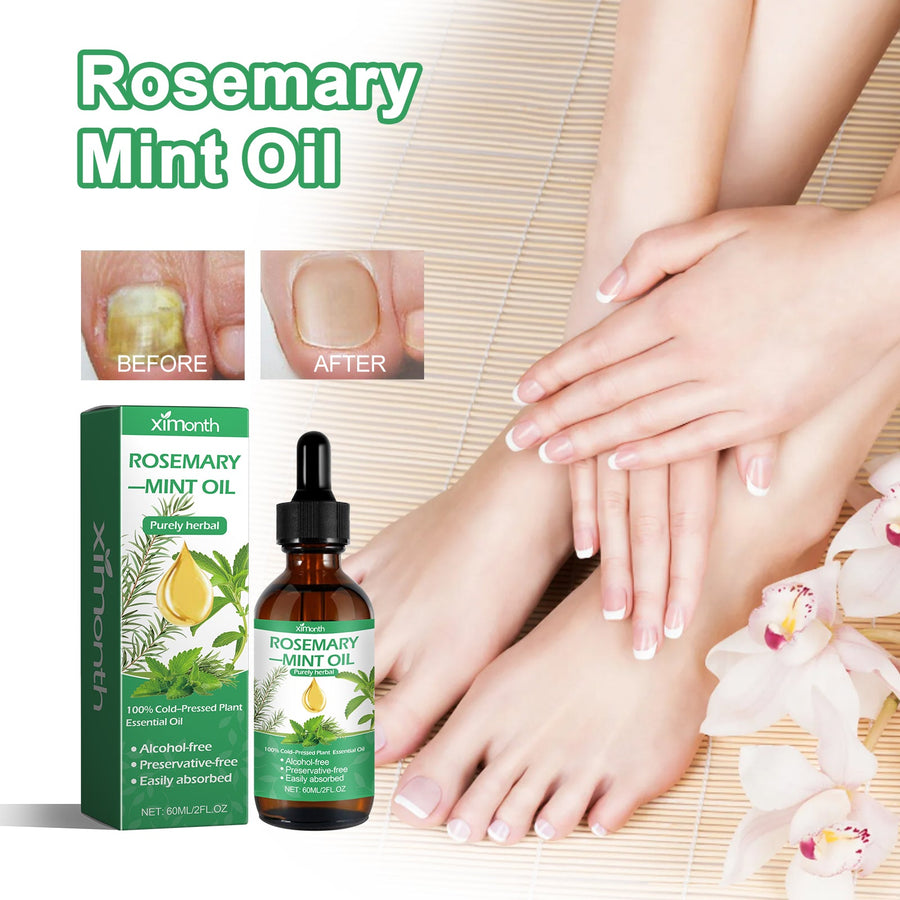 Rosemary Mint Oil — Nail Repair & Hair Strengthening Serum