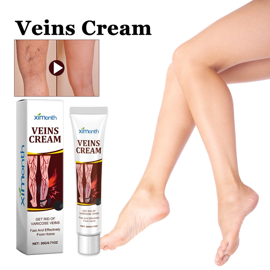Varicose Vein Cream — Targets Swelling, Pain & Visible