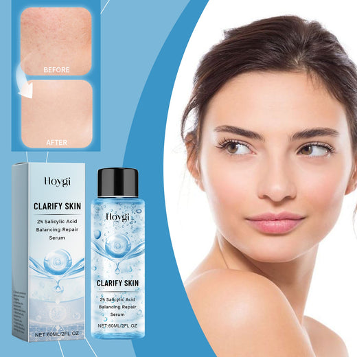 2% Salicylic Acid Serum for Acne Without Dryness