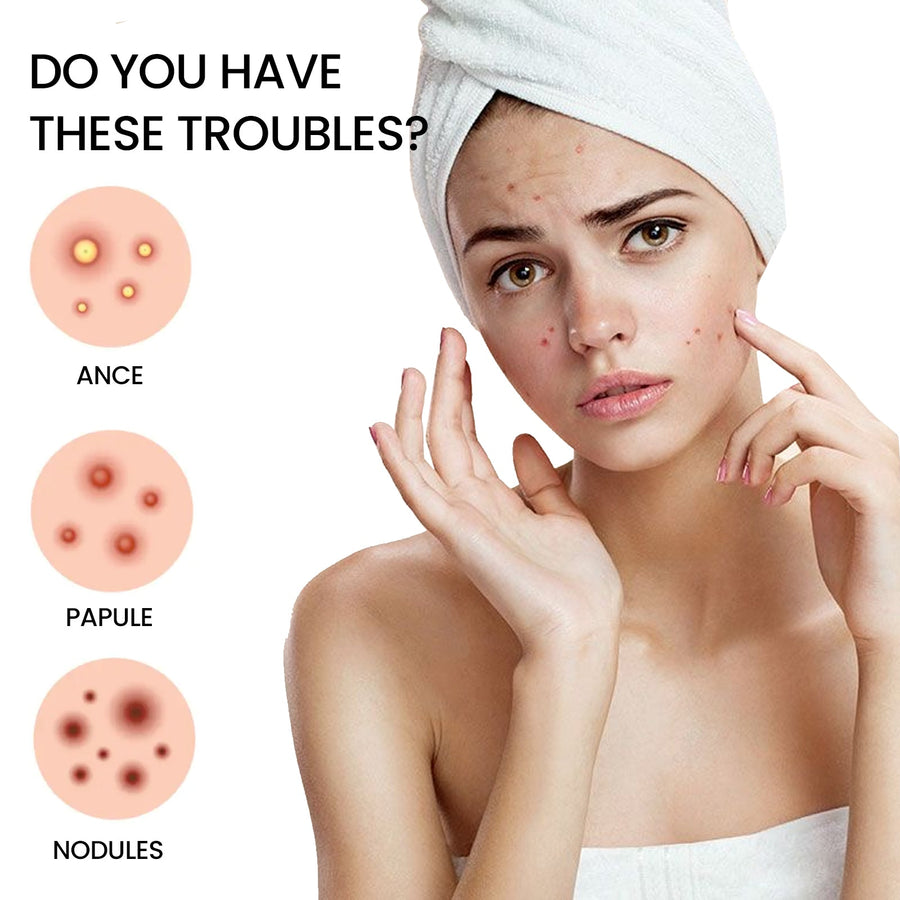 Star Hydrocolloid Pimple Patches, 200-Count Acne Set