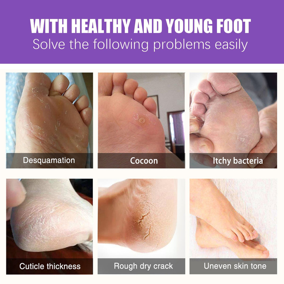 Ginger Foot Mask Booties for Cracked Dry Heels, 4 Pairs