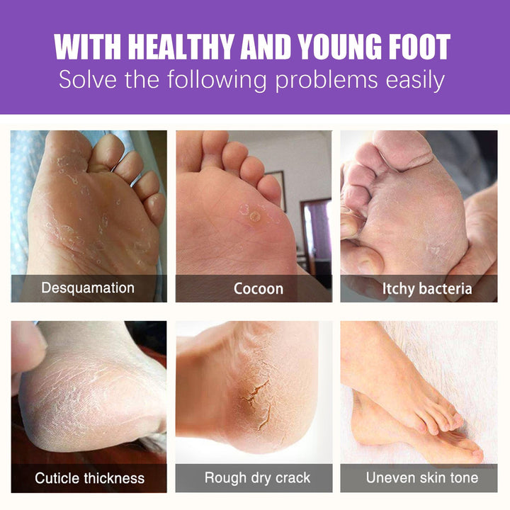 Ginger Foot Mask Booties for Cracked Dry Heels, 4 Pairs