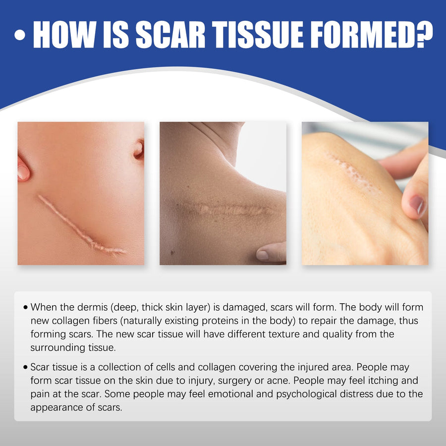 Silicone Scar Sheets for Smooth, Less Visible Scars