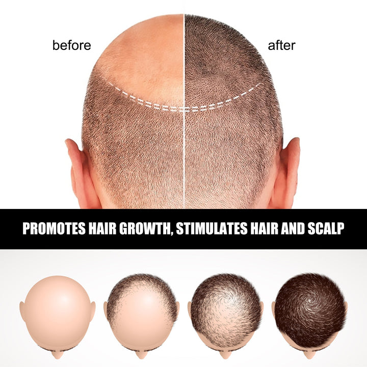 Hair Growth Ampoule Serum for Fuller-Looking Hair