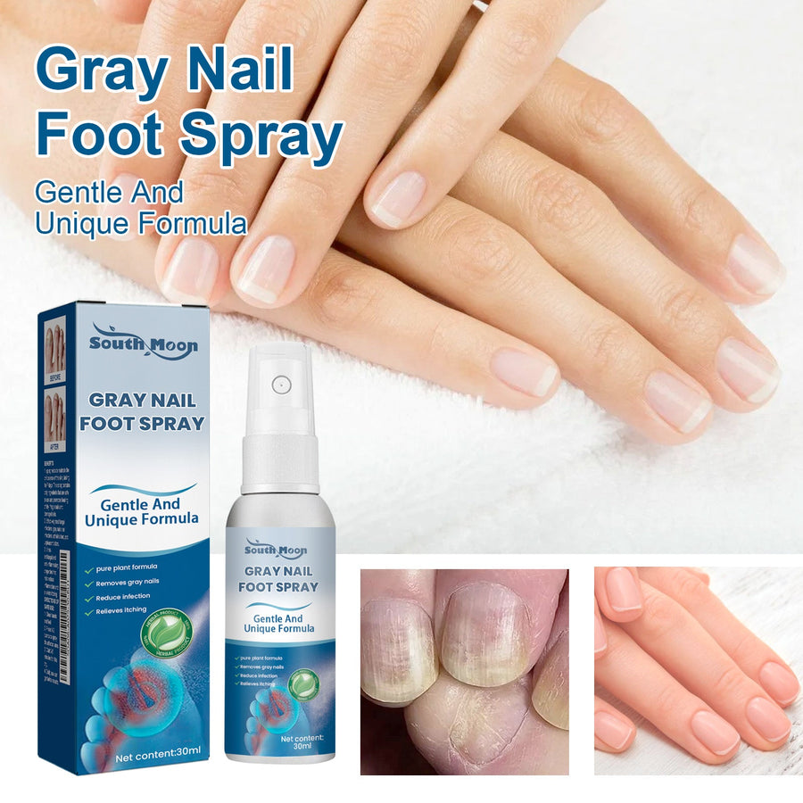 Gray Nail Foot Spray – Gentle Plant‑Based Nail Care