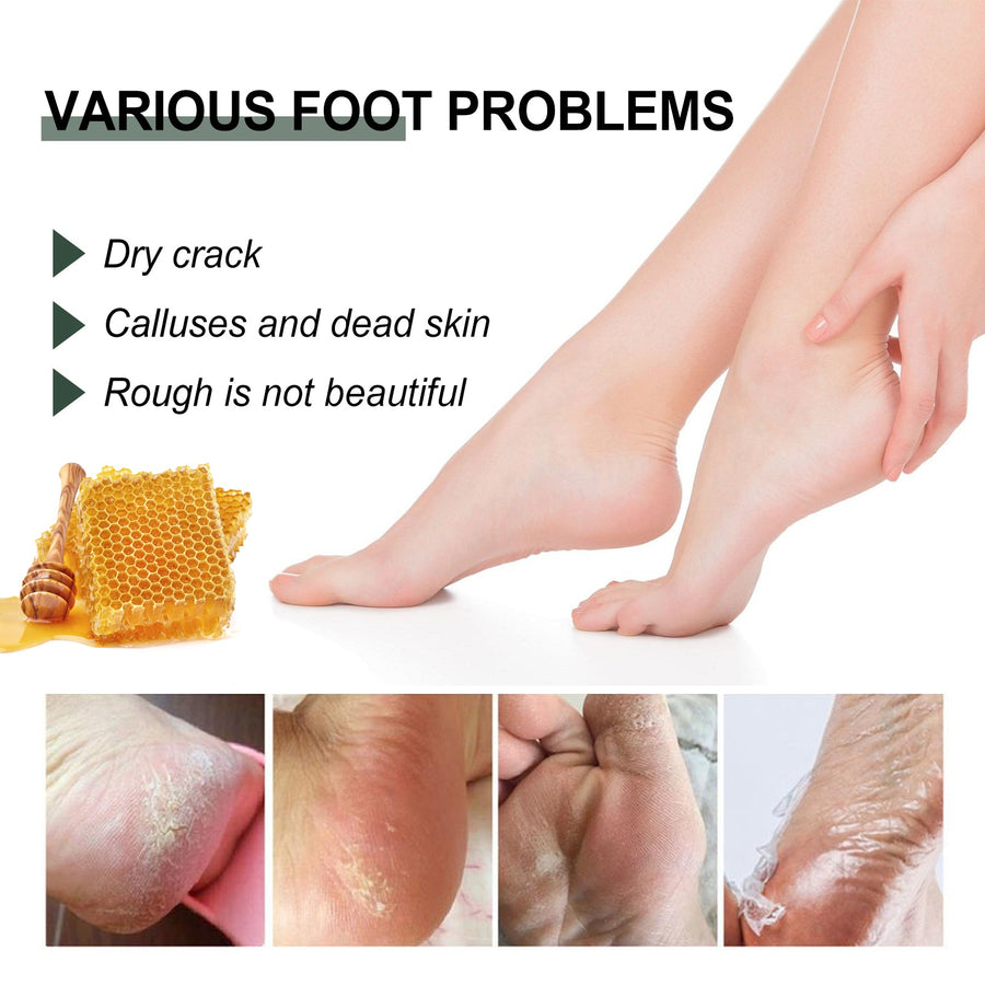 Cracked Heel Cream for Softer Hands, Feet & Calluses