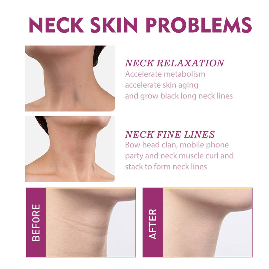 Hydrolyzed Collagen Neck Cream for Smoother Neck Lines