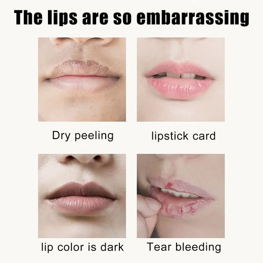 Cherry Crystal Lip Mask — Brighten Lips & Smooth Lines