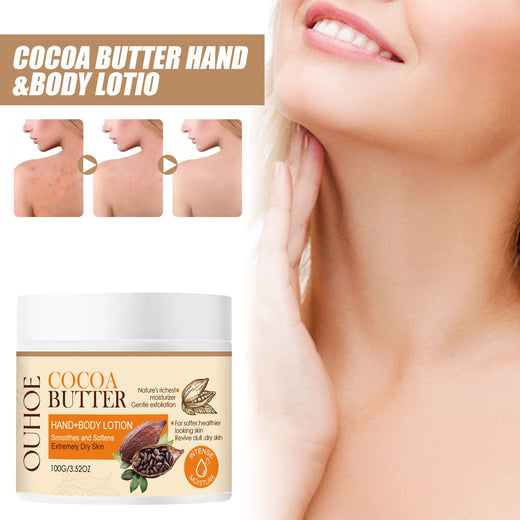 Cacao Body Lotion for Dry Skin & Acne Marks