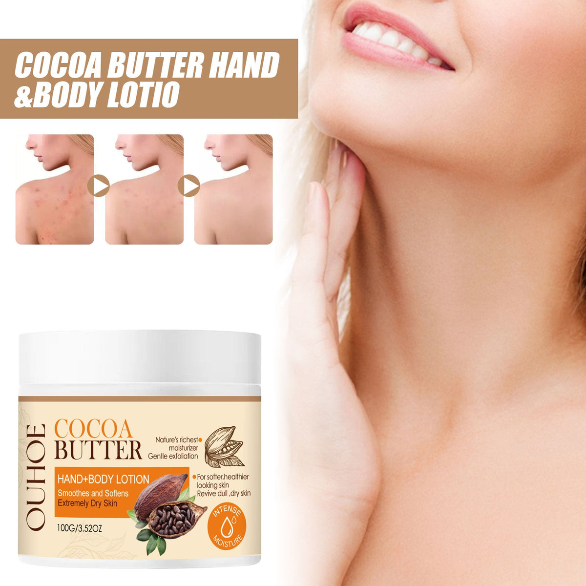 Cacao Body Lotion for Dry Skin & Acne Marks