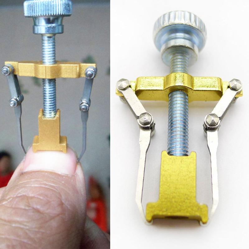 Ingrown Toenail Corrector — Safe, Non-Invasive Pain Relief