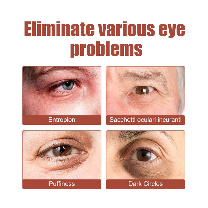 Eye Cream for Fine Lines, Bags & Dark Circle Care