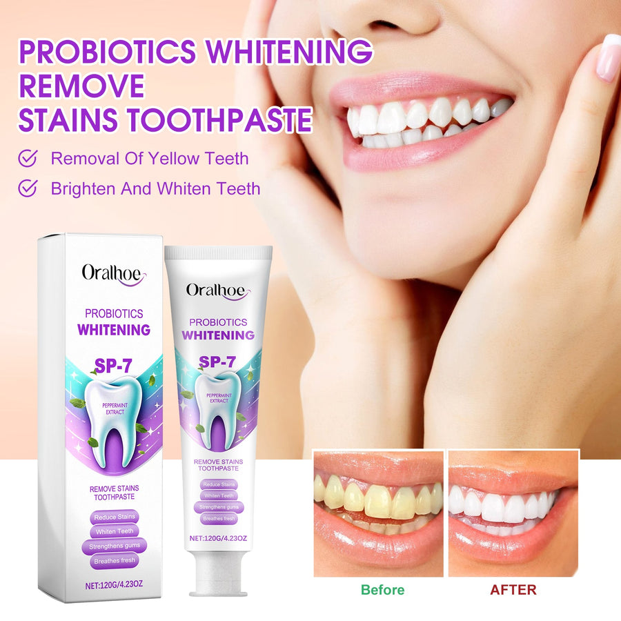 Probiotic Whitening Toothpaste – Stain Removal & Teeth