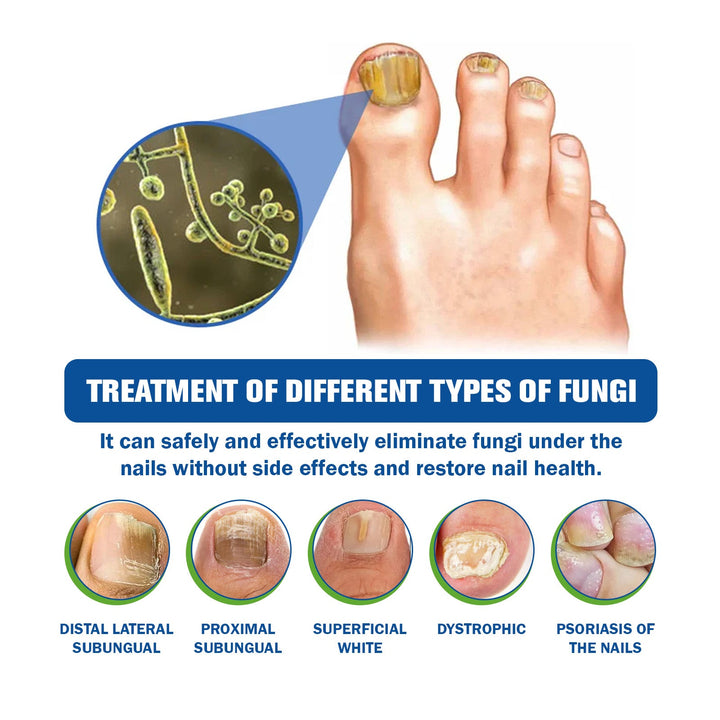 EOHOE Laser Nail Device for Fungal Nail Care at Home