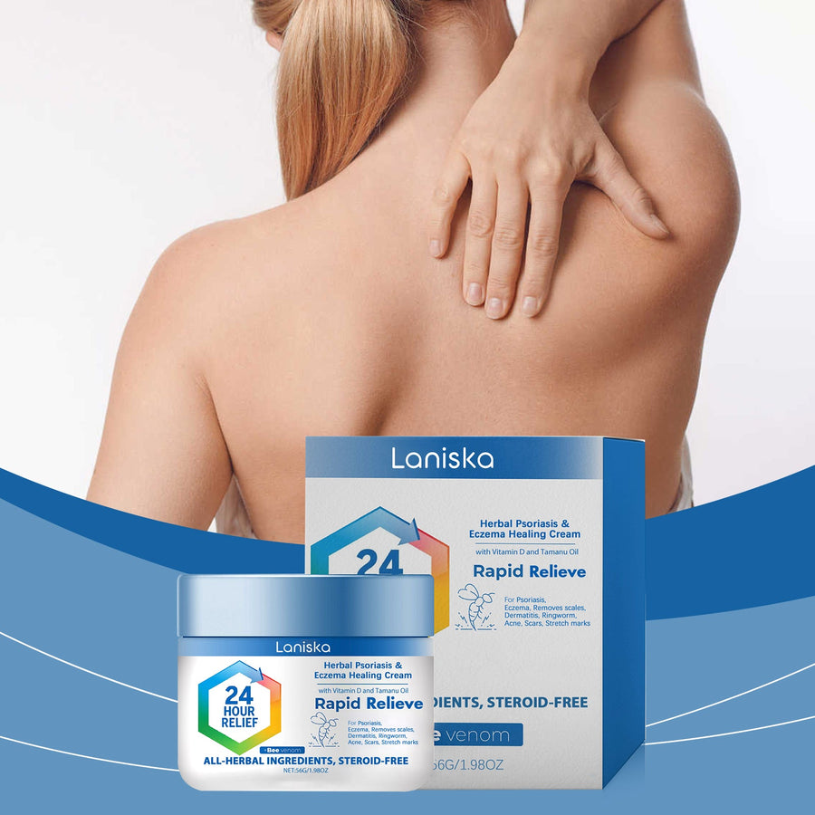 Herbal Eczema Relief Cream for Dry, Red, Irritated Skin