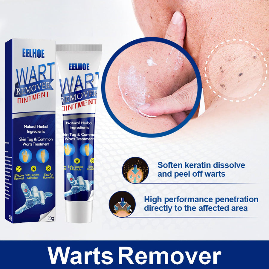 Wart Remover Ointment — Painless Herbal Wart & Skin Tag