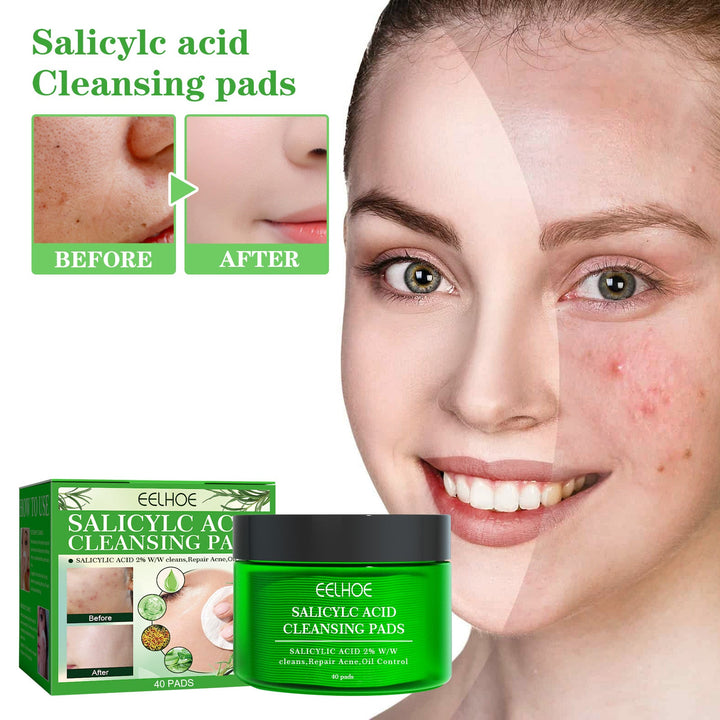 Glycolic Acid Facial Pads — Smoother, Brighter Skin in Days