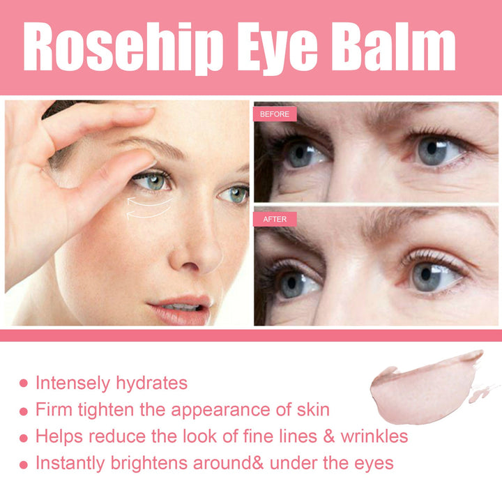 Rosehip Eye Balm Stick for Brighter, Smoother-Looking Eyes