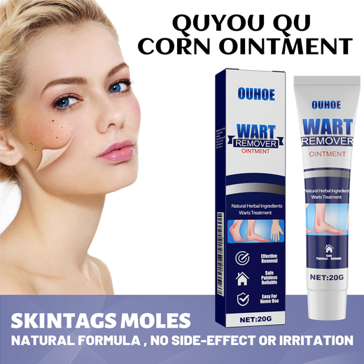 Wart Remover Ointment — Painless Natural Removal at Home