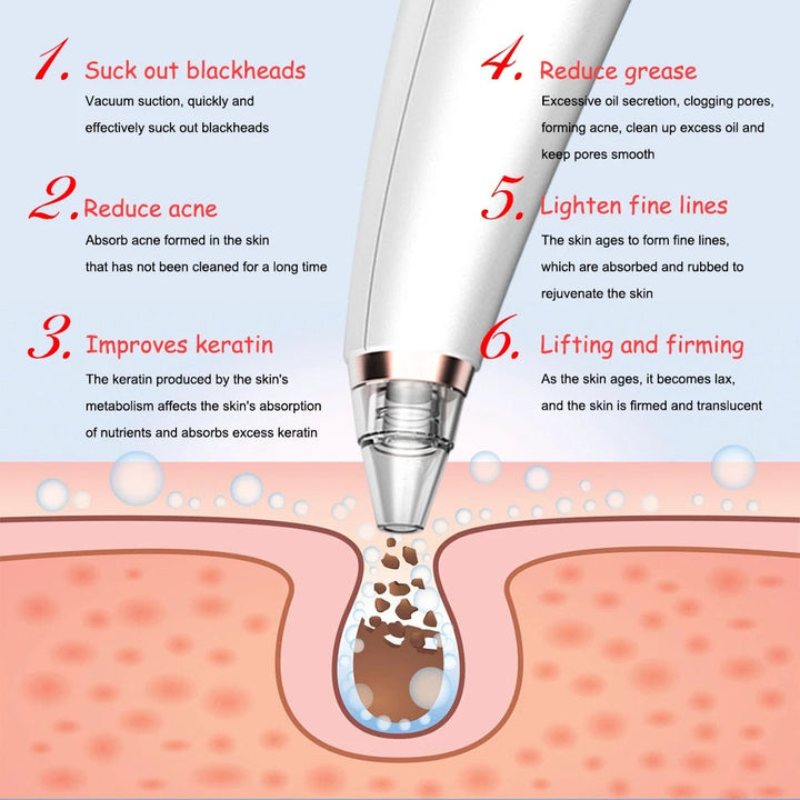 Blackhead Remover Vacuum — Professional Pore Cleansing at Home