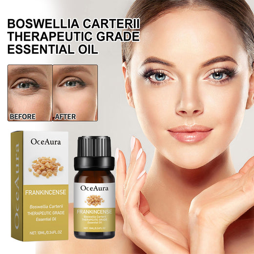 Frankincense Essential Oil for Fine Lines & Firmer Skin