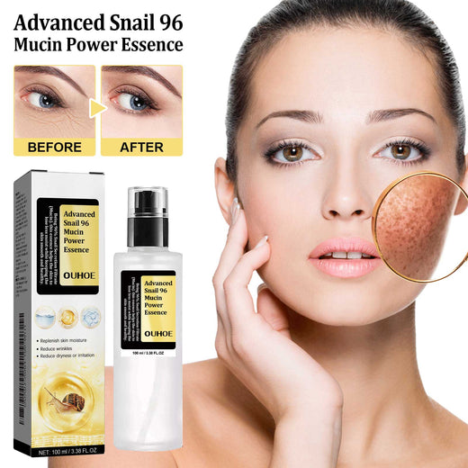 Snail 96 Mucin Essence for Wrinkles and Dry Skin