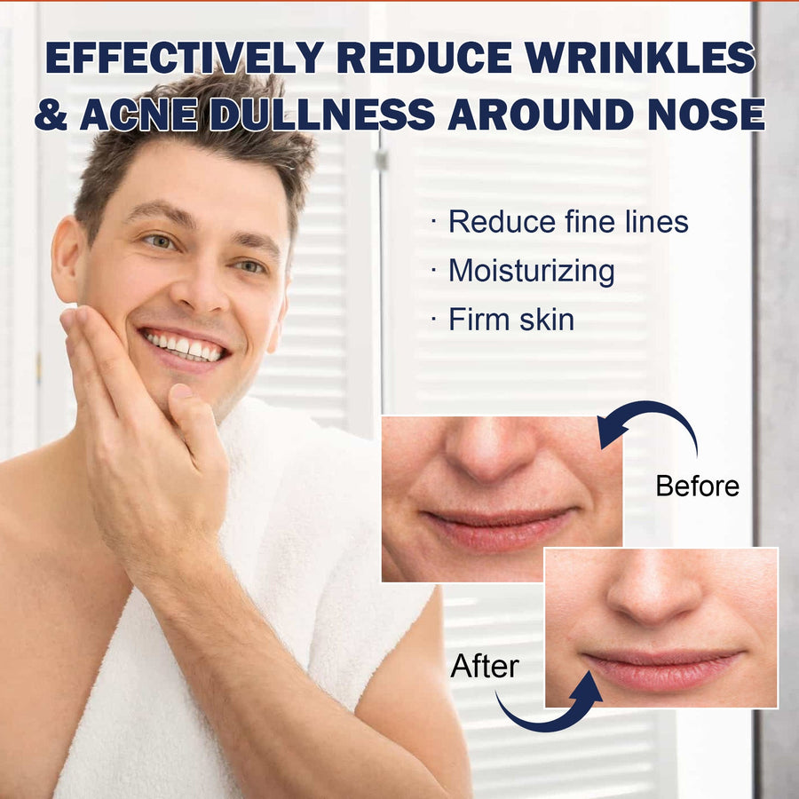 Men's Nasolabial Fold Patches for Smoother-Looking Skin