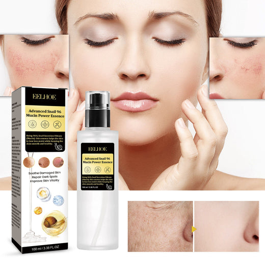Snail Mucin 96% Essence for Fine Lines & Dark Spots