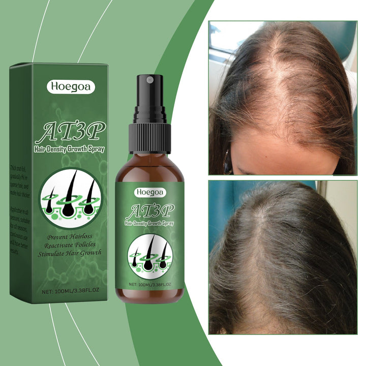 Hair Growth Spray for Fuller-Looking, Nourished Hair