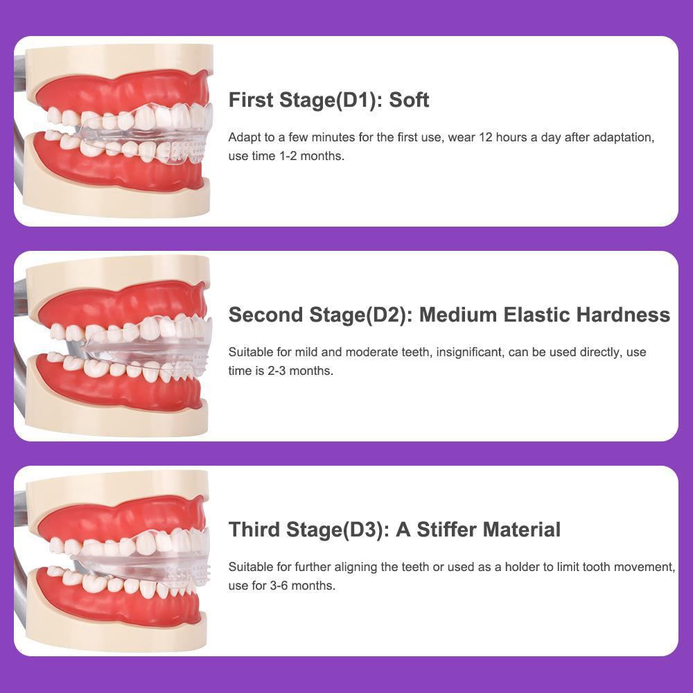 Clear Braces for Adults — Invisible 3-Stage Teeth Correction