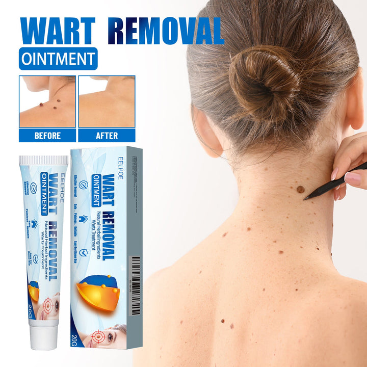Keyu Cream Clean Skin Repair Care Body Face Remove Face Labe