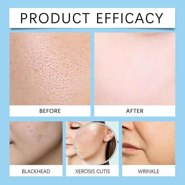 Hyaluronic Acid Serum for Hydrated, Smoother-Looking Skin