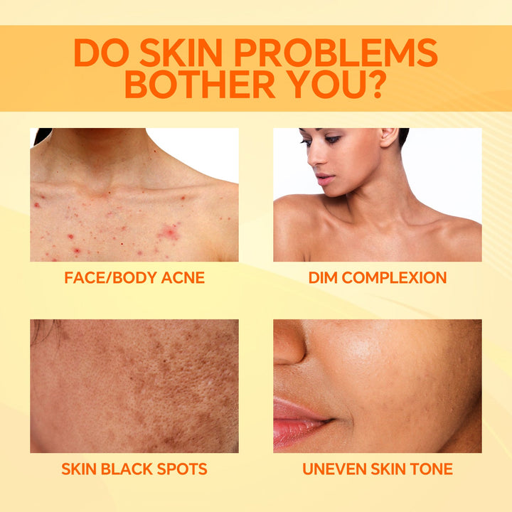 Koji Acid Soap for Brighter, Smoother Face and Body