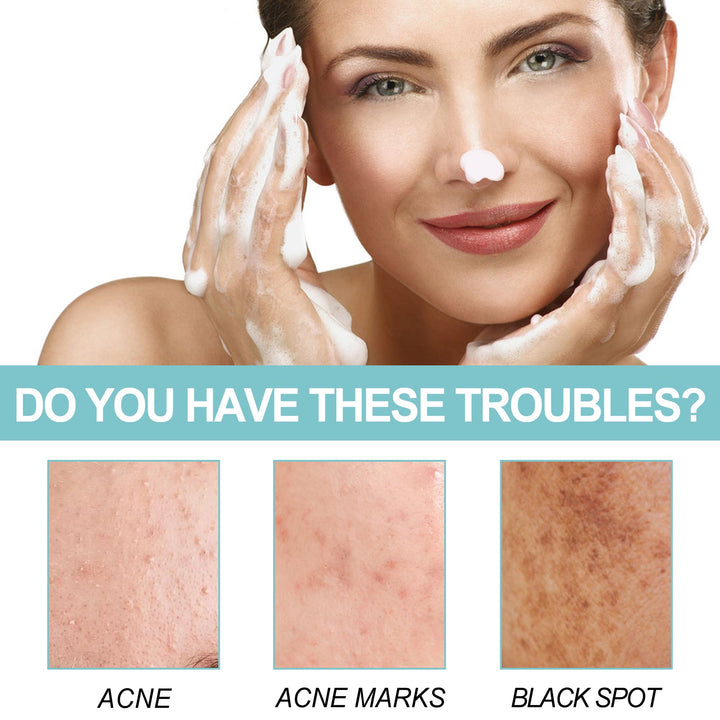 Silk Protein Repair Soap — Clear Acne and Dark Spots