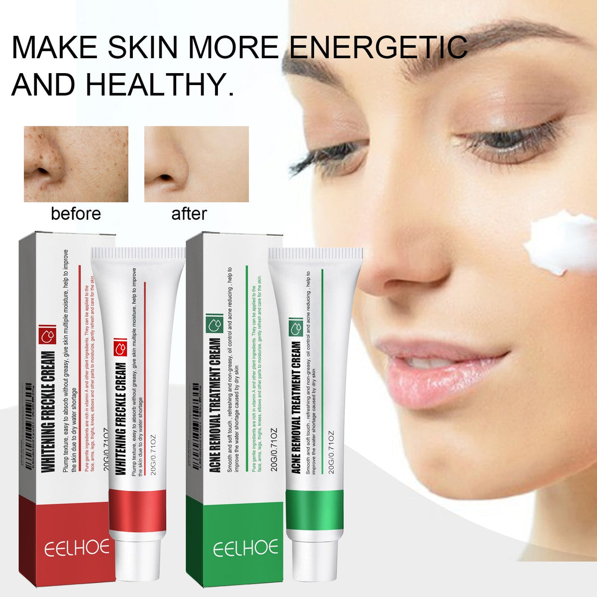 Dual-Formula Acne Cream Set — Clear Skin & Fade Dark Spots