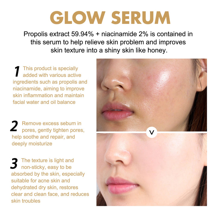 Propolis Niacinamide Brightening Serum — Fade Acne Marks