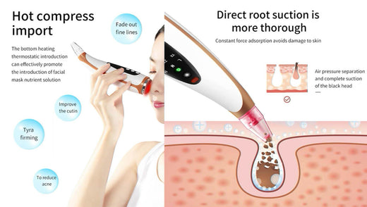 Electric Blackhead Remover With Heated Pore Cleansing