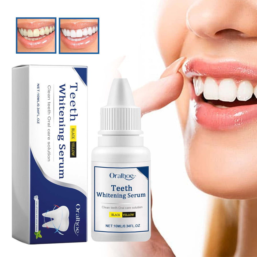 Teeth Whitening Serum — Visibly Whiter Teeth in Days