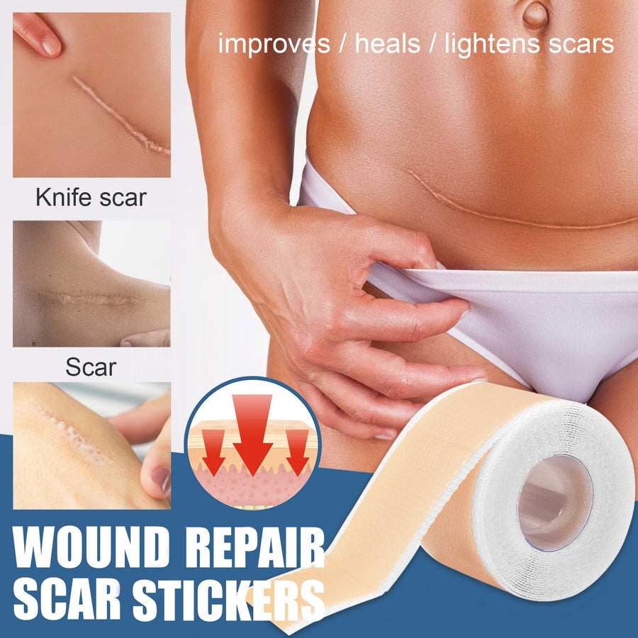 Silicone Scar Tape for Smoother, Lighter-Looking Scars