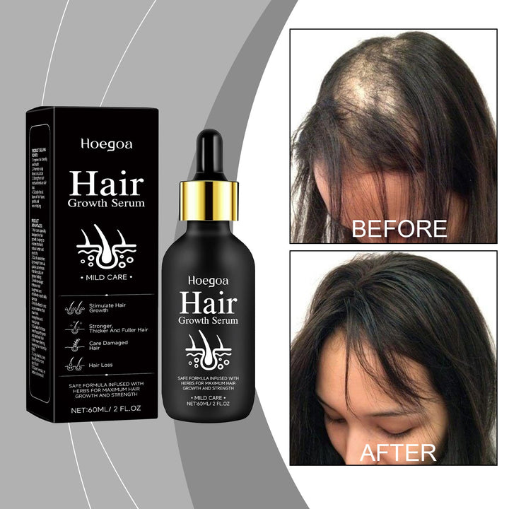 Hair Growth Serum for Lightweight Daily Scalp Care